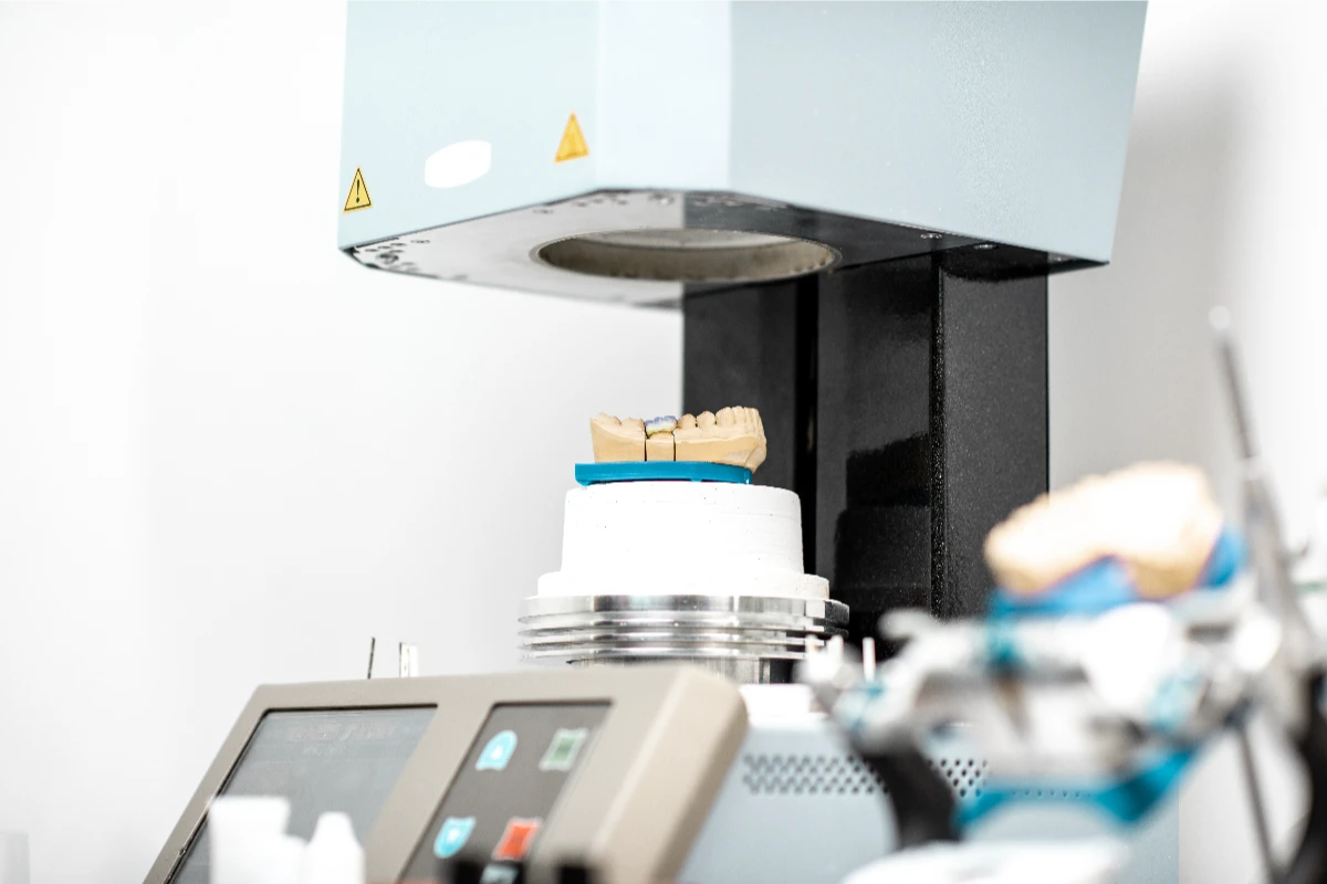 3-on-6 implant bridges and dental lab work