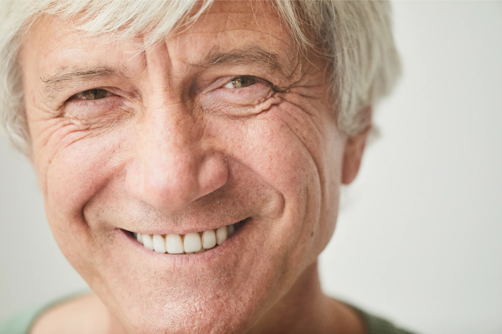 All-on-4 vs 3-on-6 Dental Implants: Which Is Right for You?