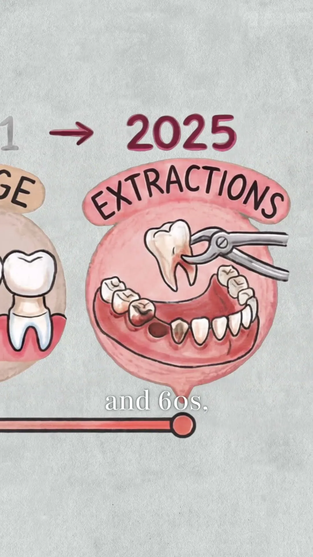 The Problem With Fixing One Tooth at a Time
