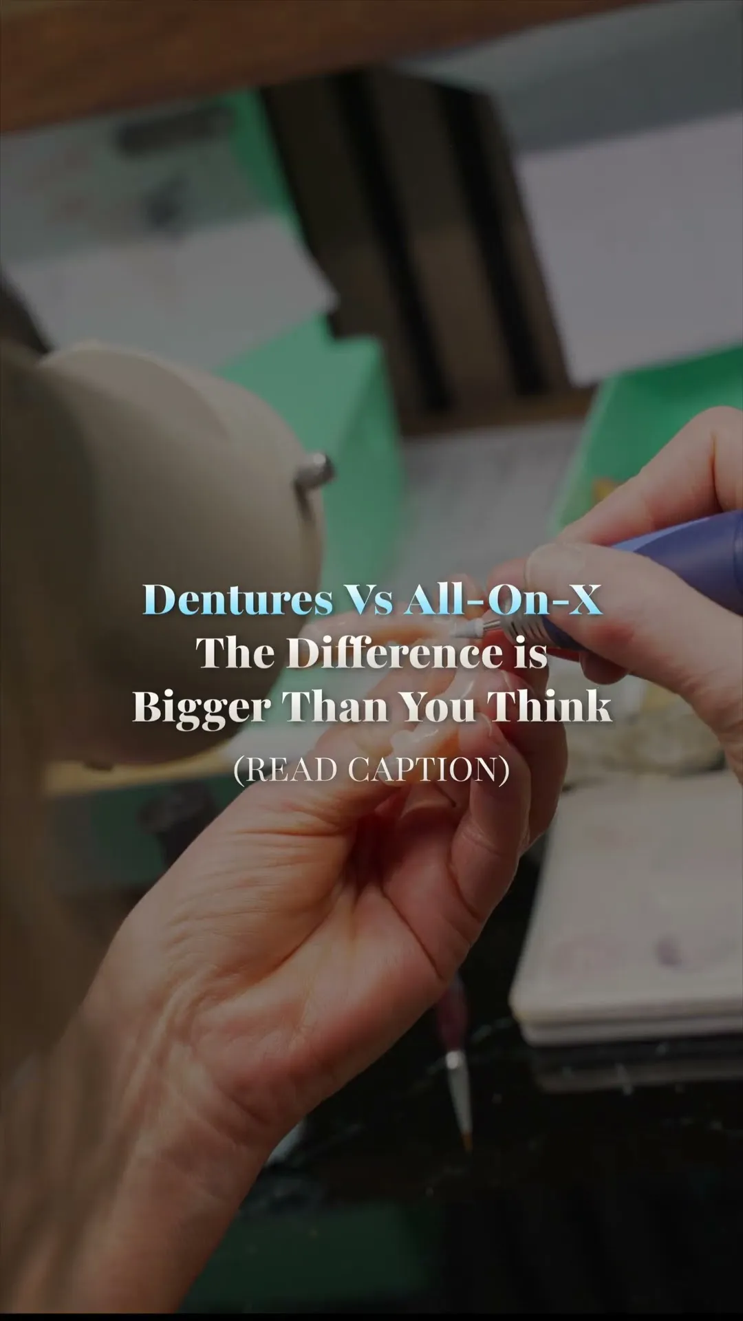 Dentures vs All-on-X Dental Implants: What's the Real Difference?