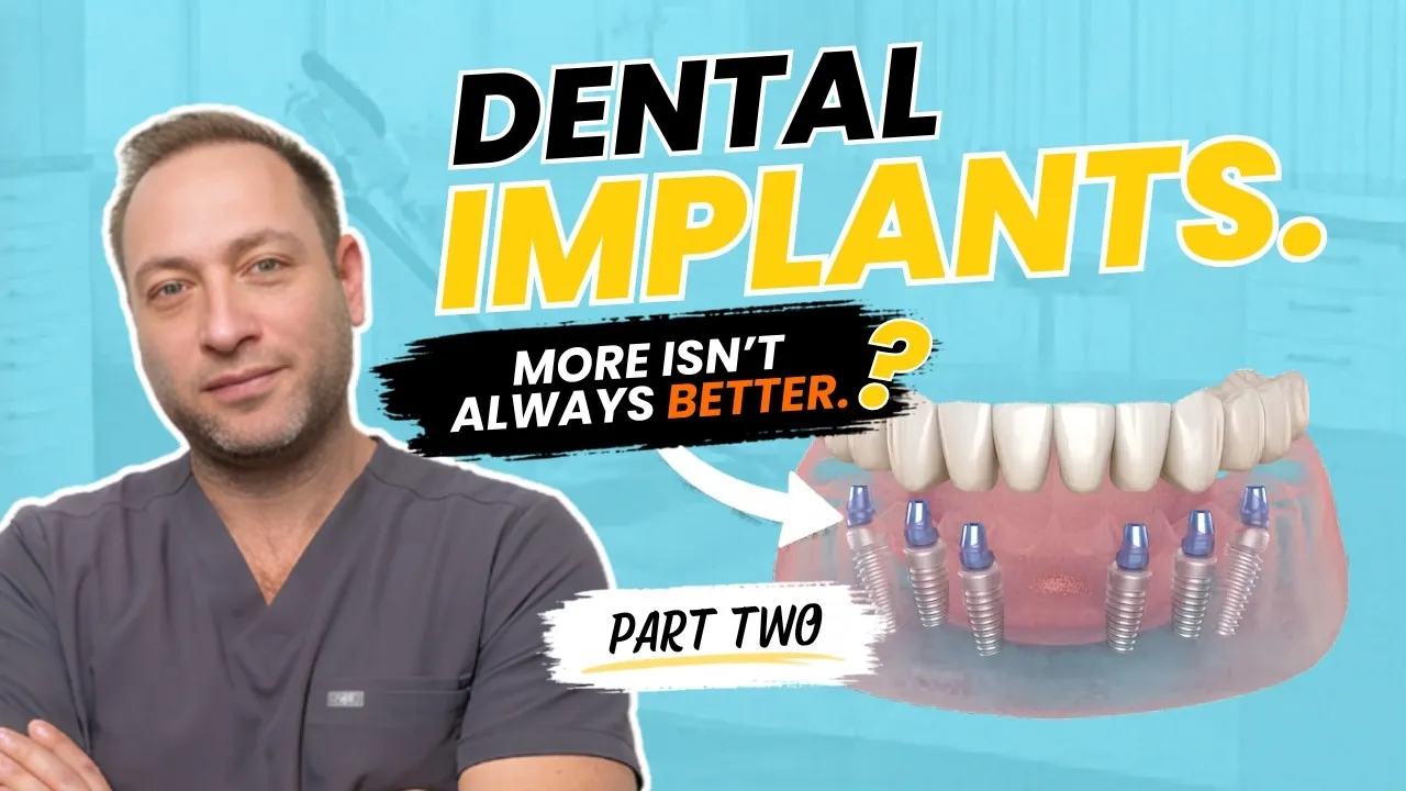 It's Not the Number of Implants That Matters, It's the Location (Part 2)