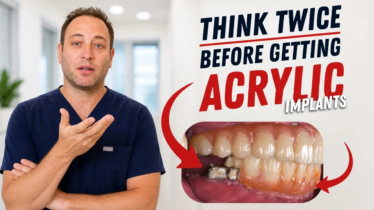 The Truth About Acrylic Dental Implants