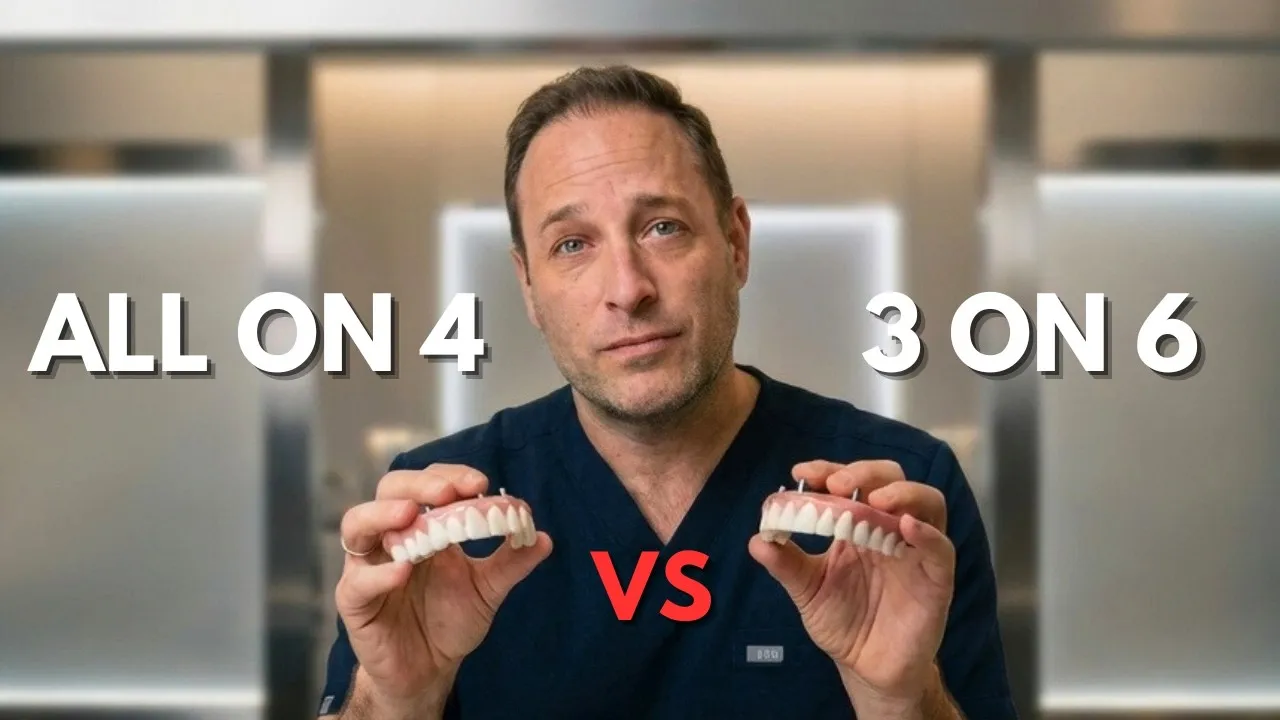 All-on-4 vs 3-on-6 Dental Implants — Dr. Gregory Broyde, Smile Now Dental Calgary