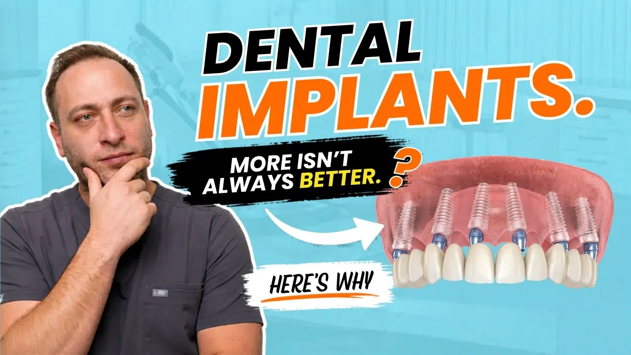 Your Dentist Says You Need 6 Implants... Ask This First (Part 1)