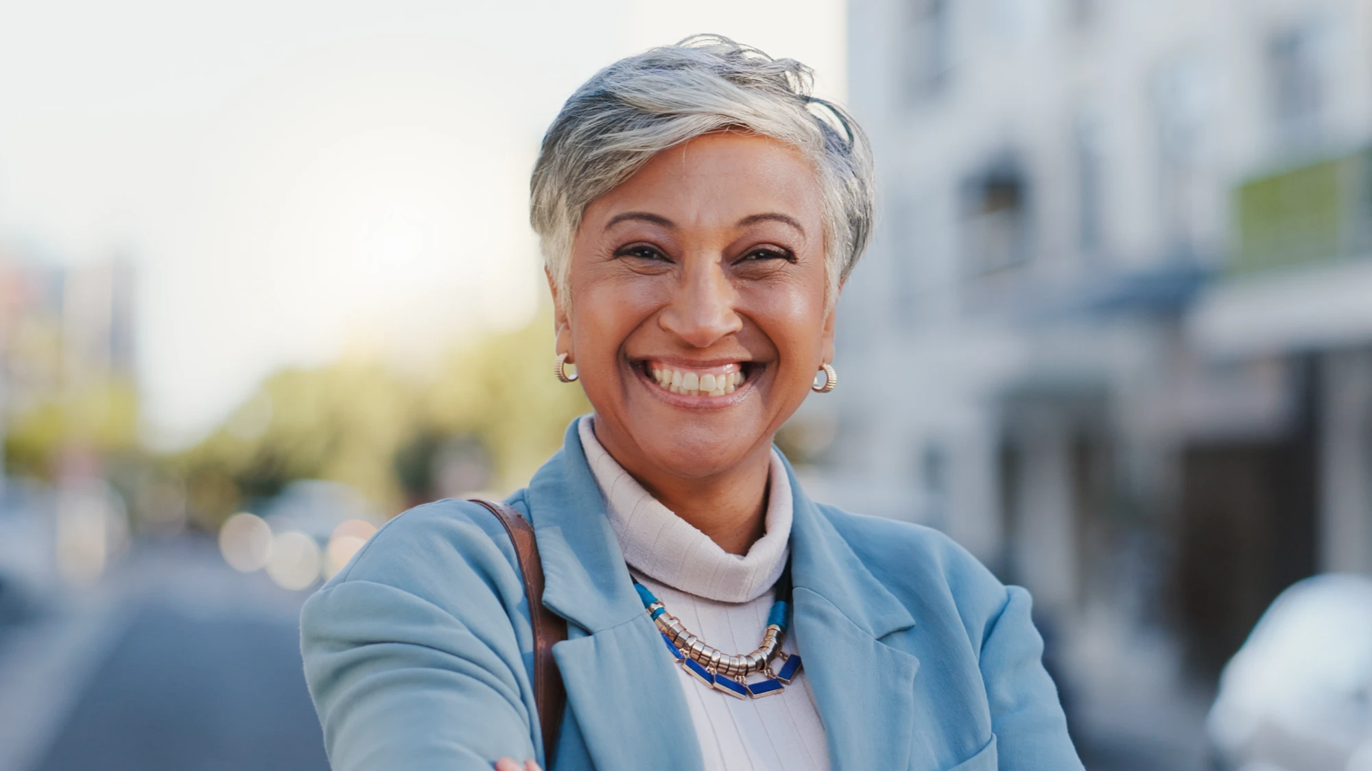 All-On-4 dental implant treatment result