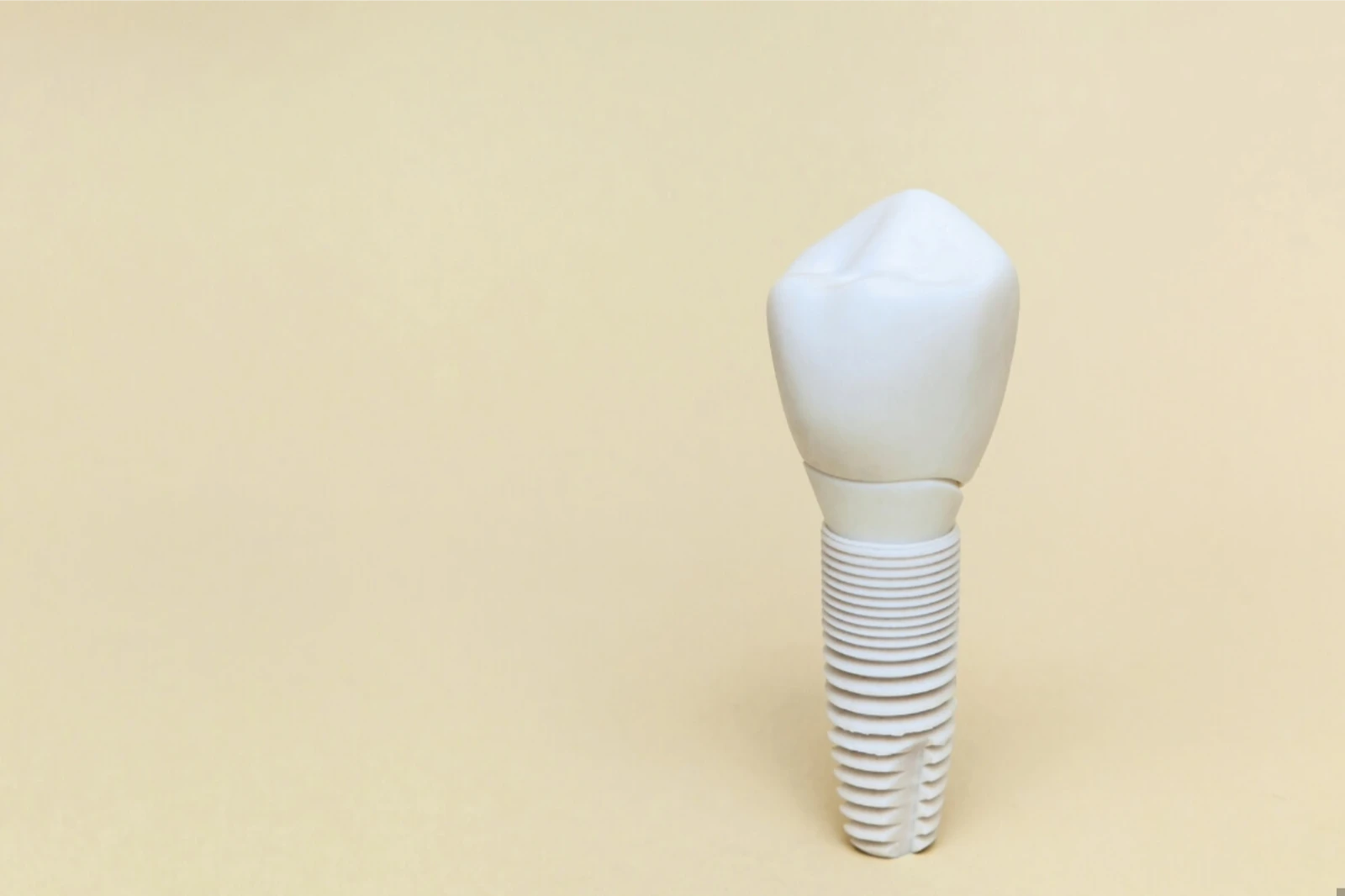 Zirconia dental implant - white ceramic tooth-colored implant